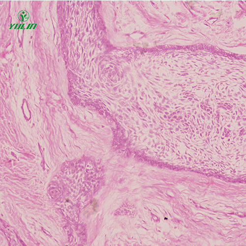 人口腔病理標本片