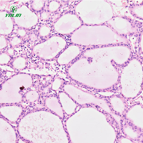 人內分泌系統(tǒng)疾病標本片
